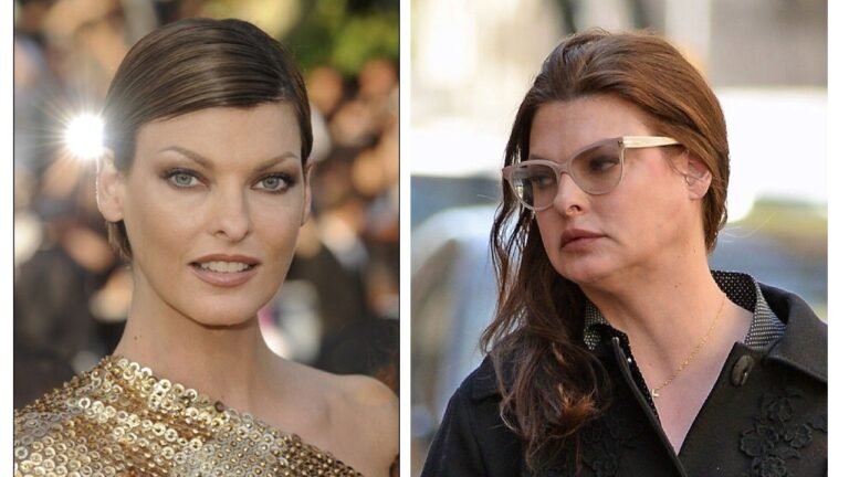 Linda Evangelista habló sobre el calvario que significó su tratamiento estético