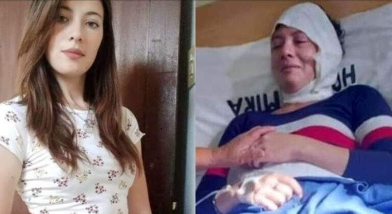 Su ex la citó para pagarle la cuota alimentaria y la quemó con aceite hirviendo