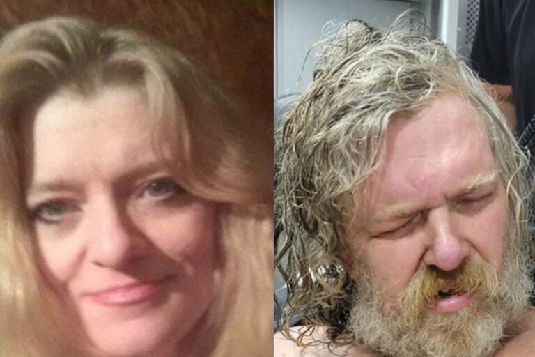 Despertó del coma y acusó a su hermano de querer asesinarla