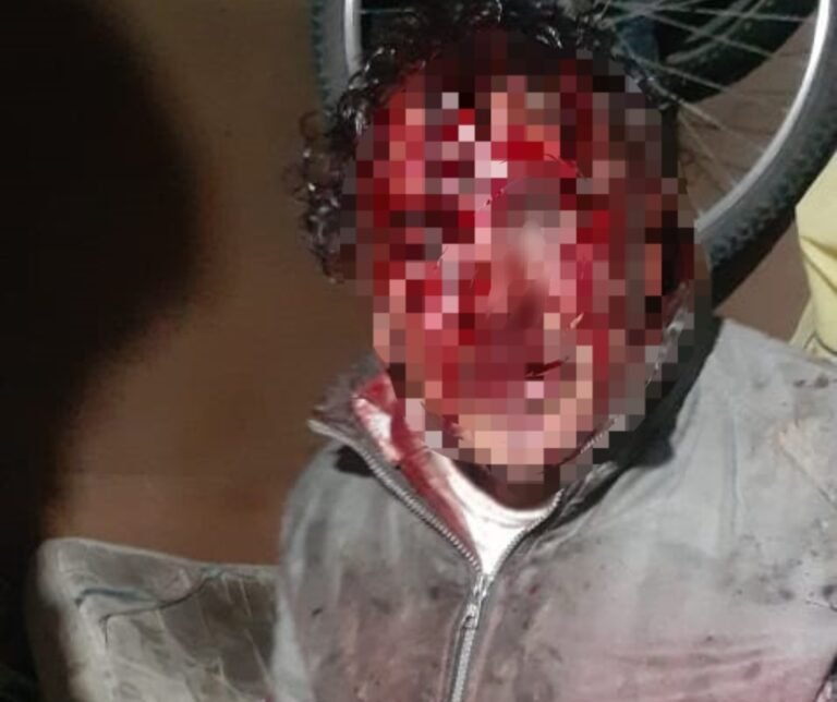 Brutal asalto a un jubilado