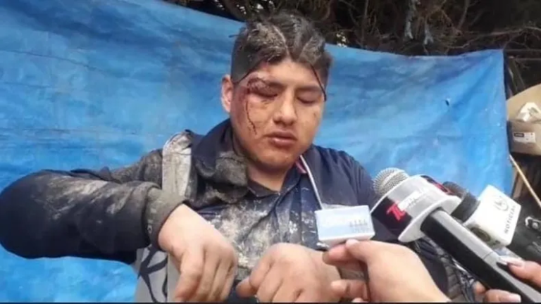 Salió a festejar y despertó enterrado adentro de un ataúd