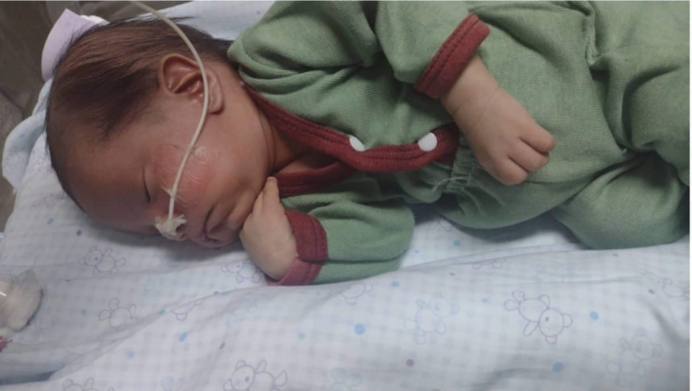 Recaudan fondos para costear los tratamientos de un bebé