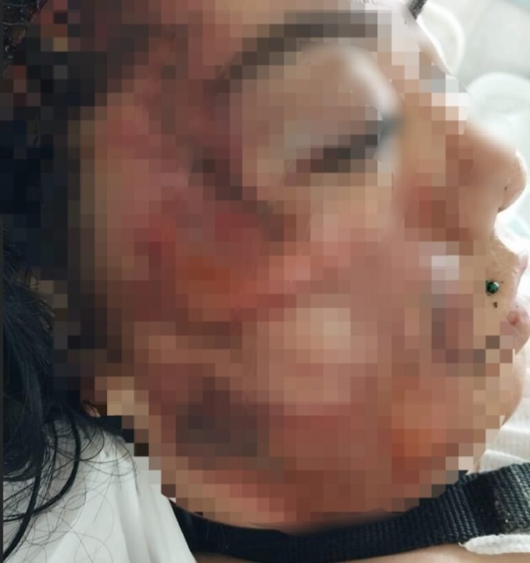 Recibió una feroz golpiza y permaneció ocho días en terapia intensiva