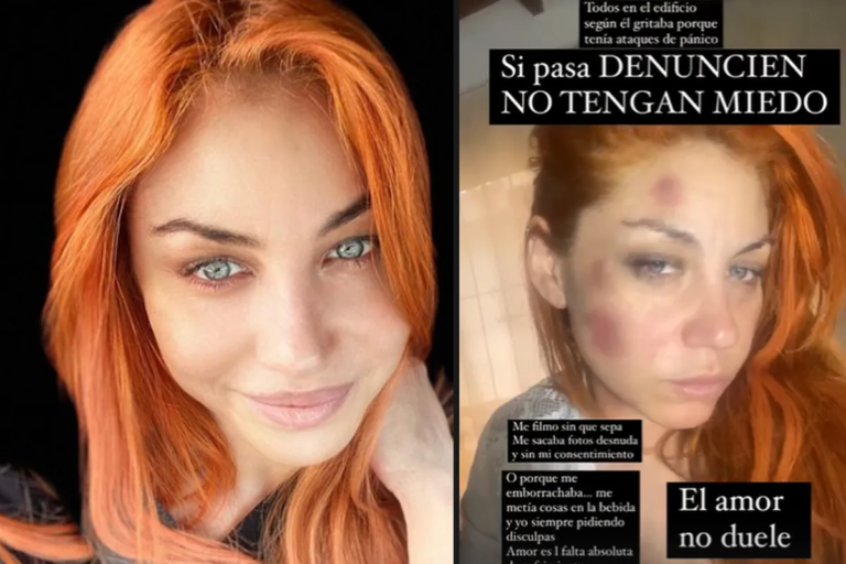 Lourdes de Bandana denunció a su exnovio por violencia de género 
