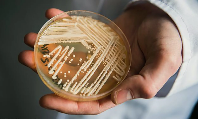 Candida auris: confirman los dos primeros casos del “súper hongo” en el país