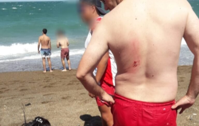 Un hombre caminaba por la costa de Playa Unión y lo atacó un lobo marino
