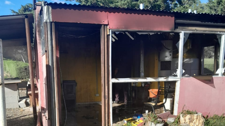 Explotó la garrafa de su casa y terminó con el 30% de las piernas quemadas