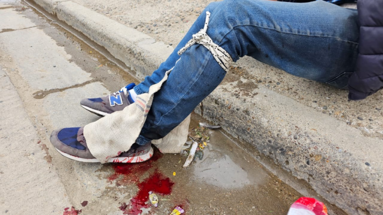 Recibió un disparo en su pierna y se negó a hacer la denuncia