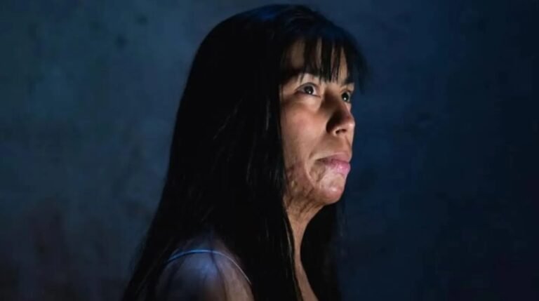 Su novio la prendió fuego, la operaron 69 veces y ahora lucha por conseguir justicia