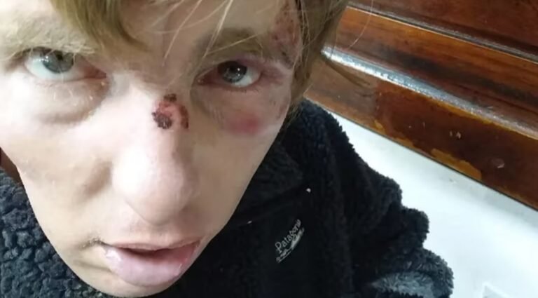 “Estaba atado y golpeado”: murió en una clínica de salud mental y su familia denuncia mala praxis