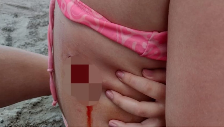 Un lobo marino mordió a una nena cuando se bañaba dentro del mar