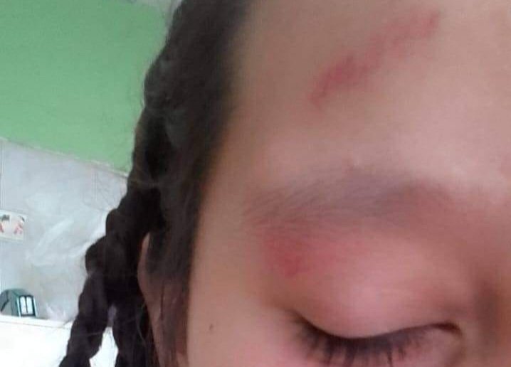 Una mujer denuncia que golpearon a su hija a la salida de la Escuela hasta dejarla inconsciente