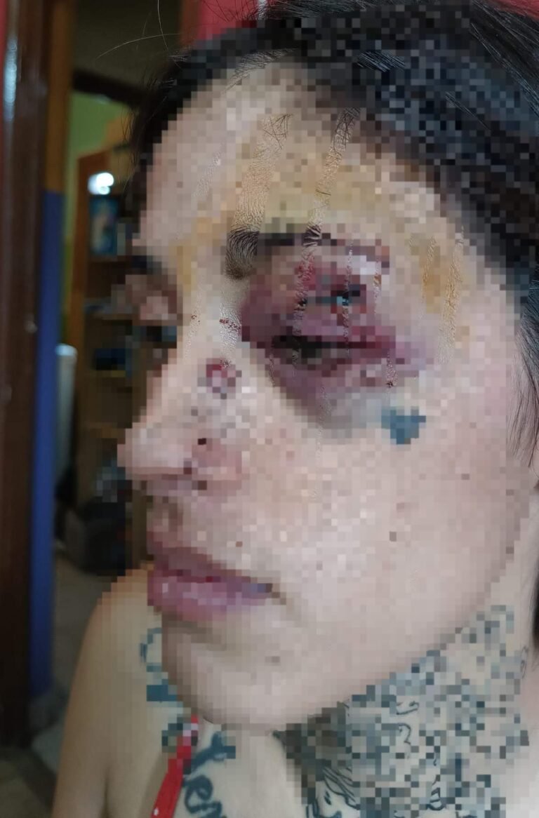 Tras tirarle un plancha para bifes le desfiguró el rostro y la amenazó de muerte