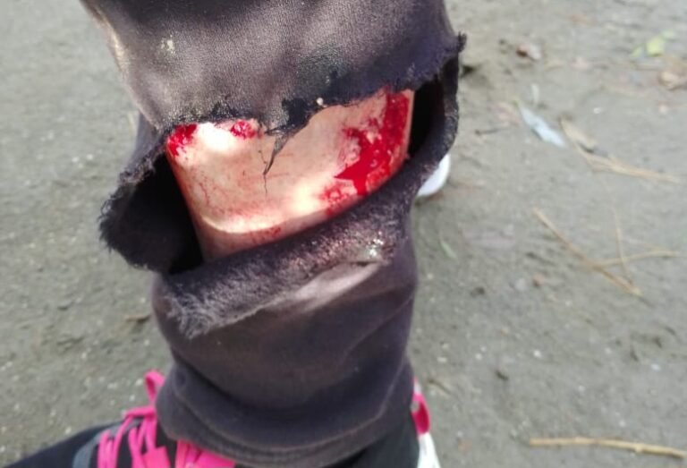 Una mujer fue atacada por un perro y debieron trasladarla al hospital