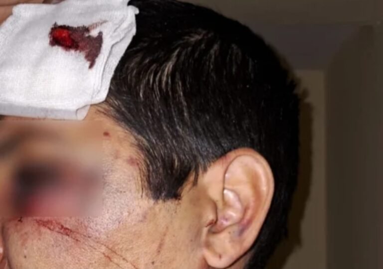 Partida de truco entre amigos terminó con una violenta pelea