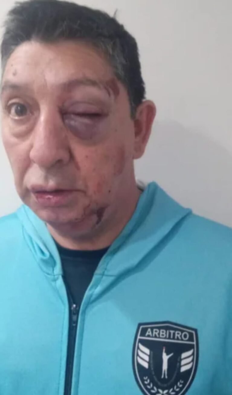 Un árbitro fue brutalmente agredido en medio de un partido de fútbol de veteranos