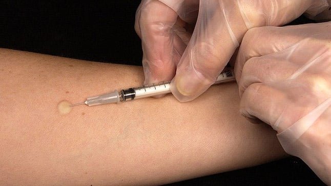 Identificaron 13 casos de tuberculosis en Comodoro