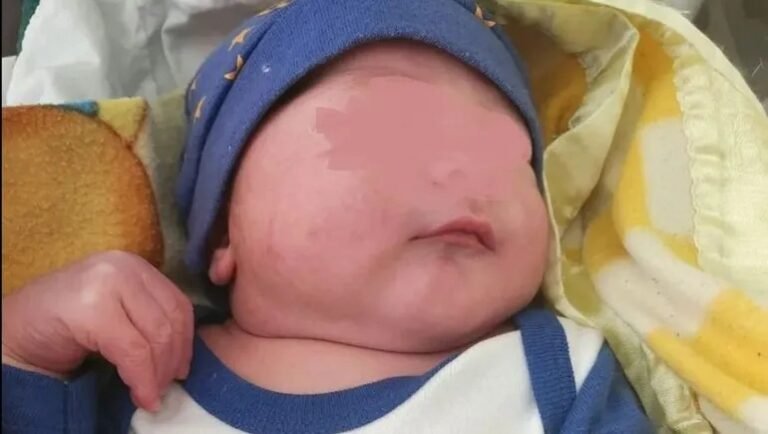 Nació un “super bebé” en Tierra del Fuego: pesó 5,890 kilos y 56 centímetros de talla