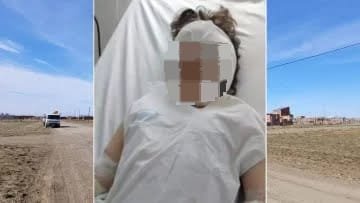 Una nena de 8 años fue atacada por un Pitbull y debieron trasladarla a Buenos Aires