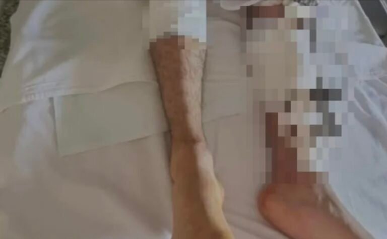 Le quebraron ambas piernas cuando iba a trabajar en su moto