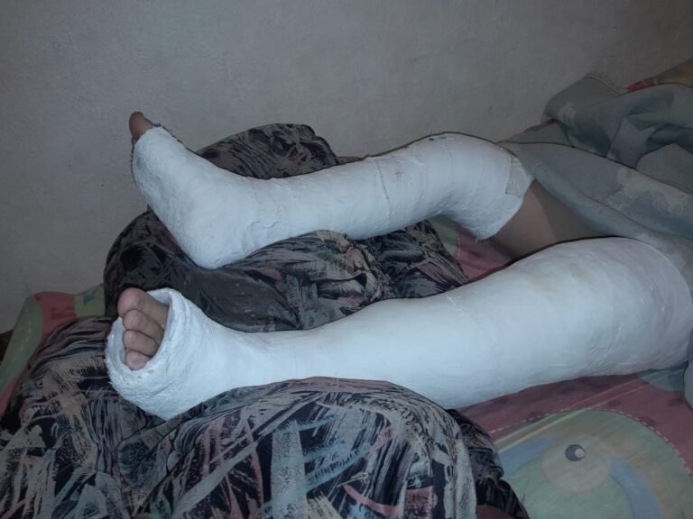 La cirugía del menor que fue atropellado en La Floresta supera el millón de pesos: “Necesito ayuda”