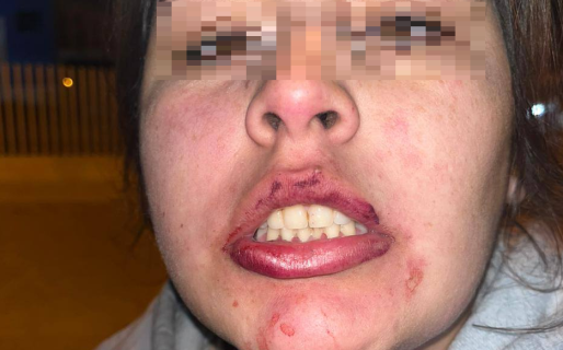 Una joven denuncia que su expareja la golpeó y amenaza con matarla