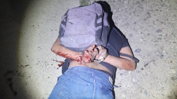 Detenido por golpear y amenazar con un cuchillo a su expareja