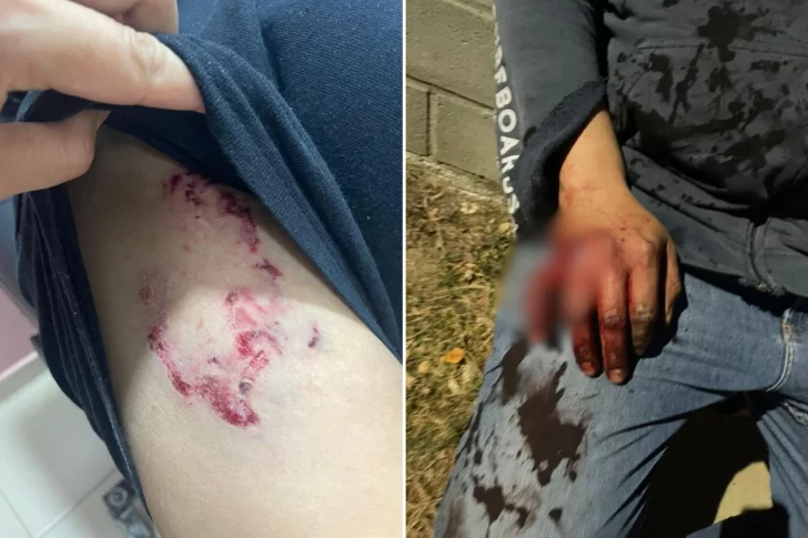 Un hombre fue acorralado y atacado por dos perros pitbulls: “Casi me mataron”