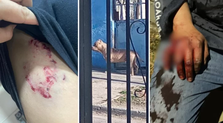 Un juez ordenó la eutanasia para dos perros pitbulls que atacaron salvajemente a un hombre