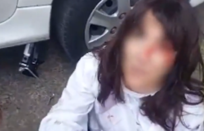 Se olvidó de poner el freno de mano y terminó atropellada por su propio auto