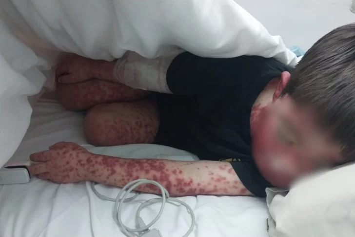 Noah tiene 4 años y una enfermedad desconocida: recaudan dinero para cubrir los gastos de la derivación