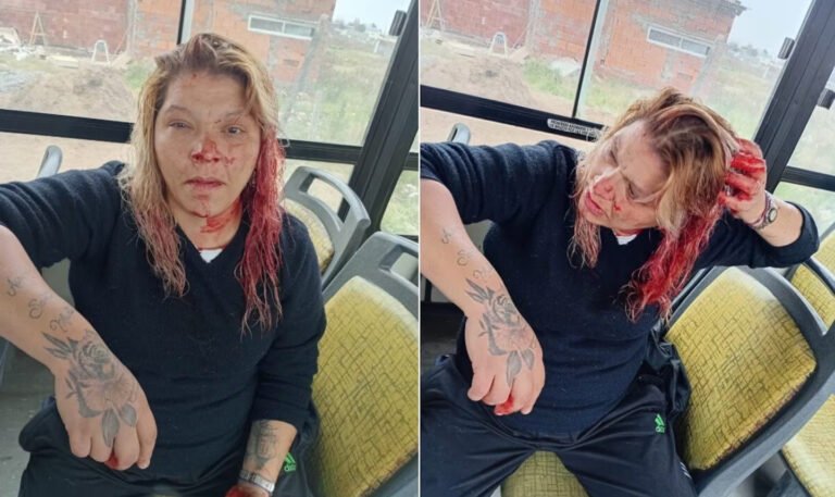 La agredieron con un caño en el colectivo por no invitar a vecinas al cumpleaños de su hija