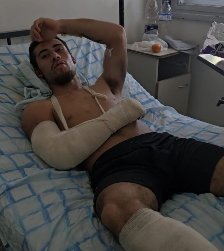 Sufrió varias fracturas tras ser atacado brutalmente y necesita una silla de ruedas