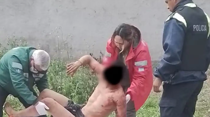 Un hombre saltó el paredón de su vecina y lo mordieron al menos 15 perros