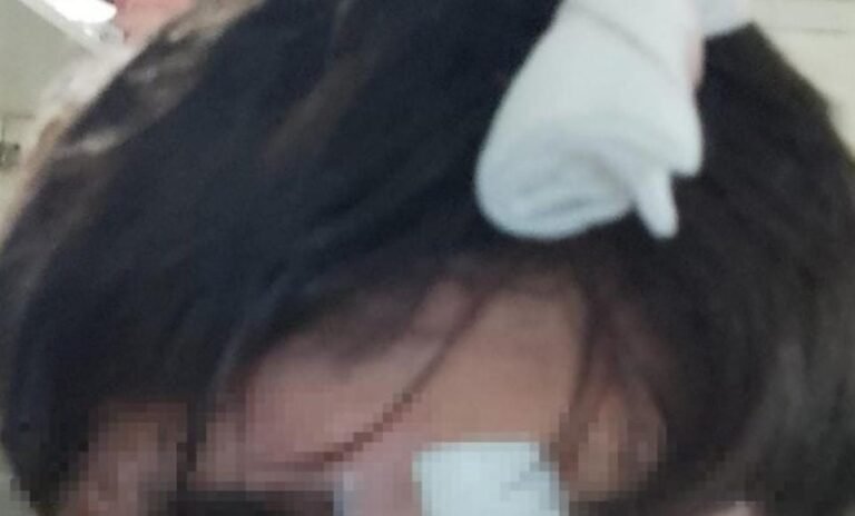 Grave denuncia: padres aseguran que su hijo con discapacidad fue golpeado por la Policía