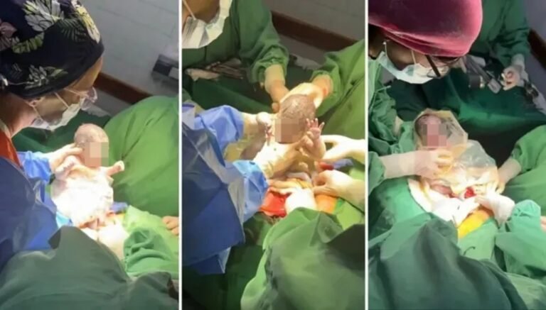 Una mujer dio a luz a trigemelas: un caso único en un millón