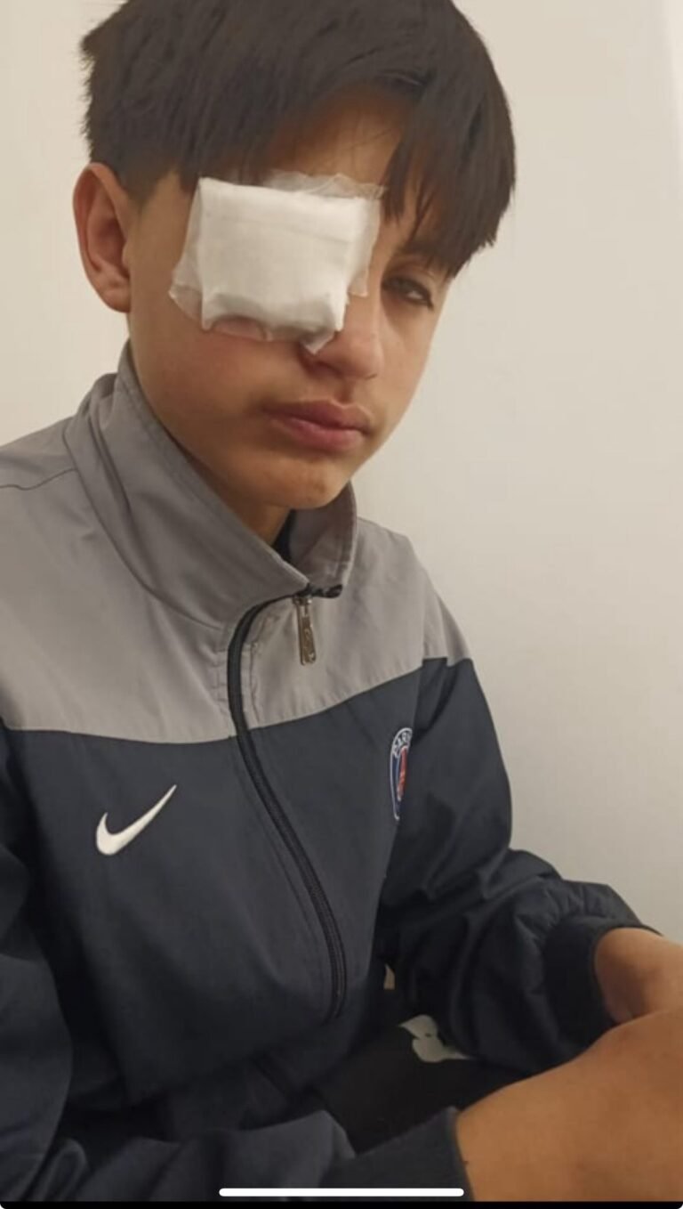 Una astilla le dañó el ojo y necesita una operación urgente: su familia pide ayuda