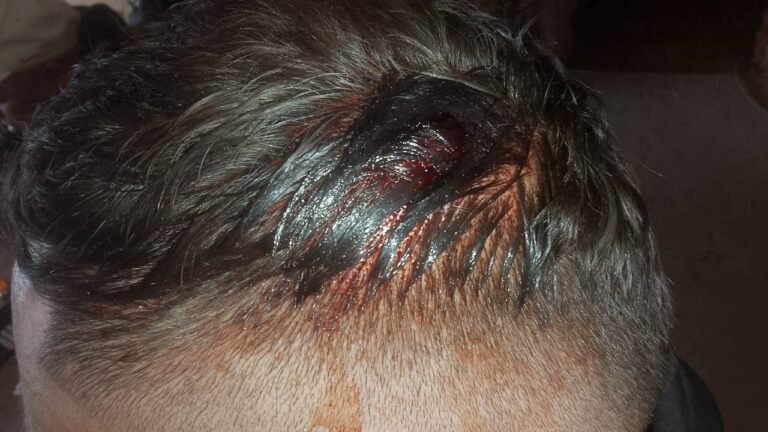 “Nos golpearon sin razón, nos robaron plata y celulares”: grave denuncia por violencia policial
