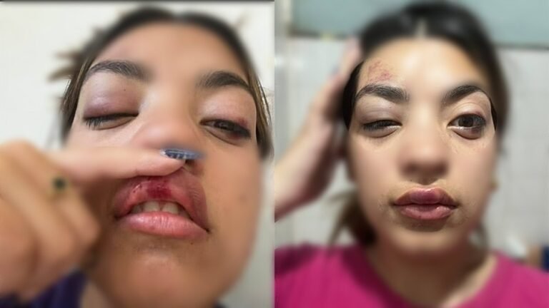 Brutal golpiza: cuatro mujeres atacaron y asaltaron a una joven a la salida de un boliche