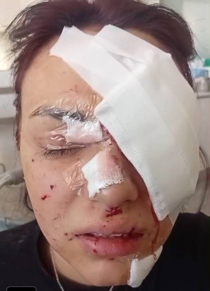 “No tenemos tiempo”: una menor sufrió un accidente y necesita $2 millones para una cirugía urgente