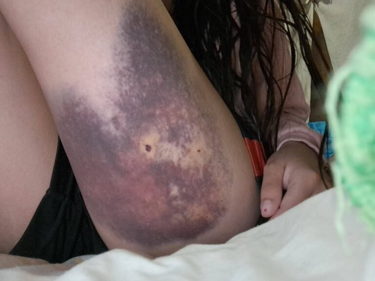 Perro suelto a metros de una escuela causó graves lesiones a una mujer