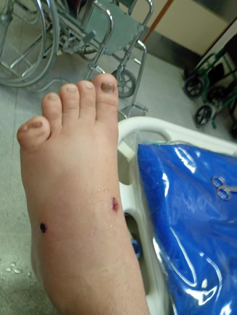 Balean a un joven de 15 años tras una fiesta: investigan a familiares de una adolescente