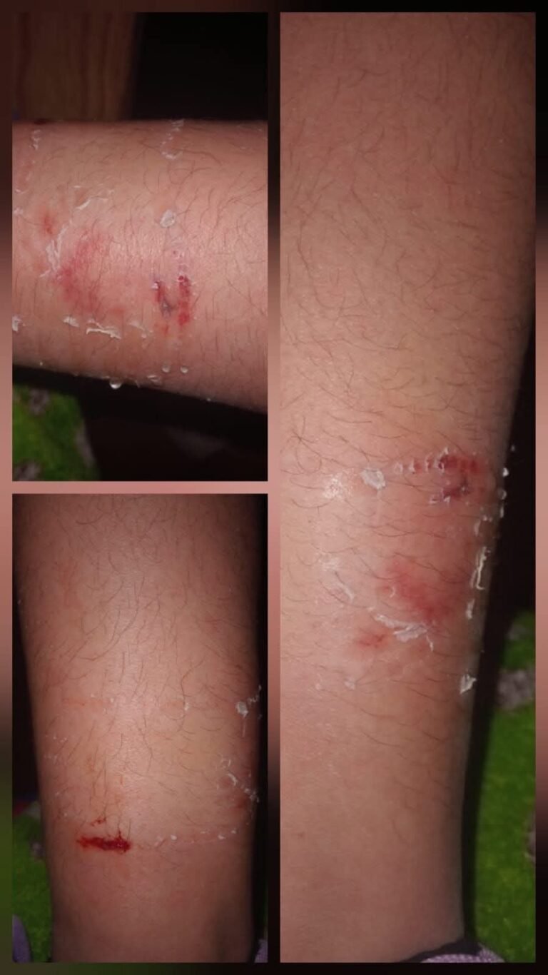 Alerta en Próspero Palazzo: denuncian ataque de perros a una menor en  Plaza Brugo