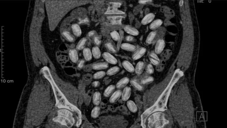 Viajaban con 500 cápsulas de cocaína en el estómago: las atraparon cuando volvían de un tour de compras