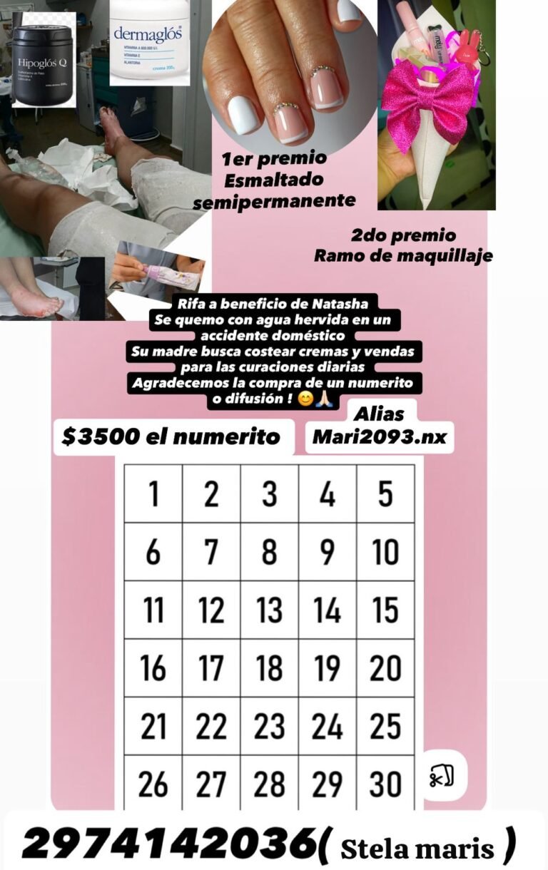 Organizan una rifa para ayudar a una niña que sufrió quemaduras en un accidente doméstico