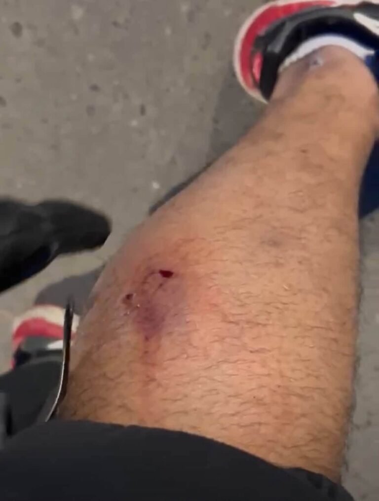 Denuncian que un perro mordió a un vecino en Km5 y cuestionan a sus dueños