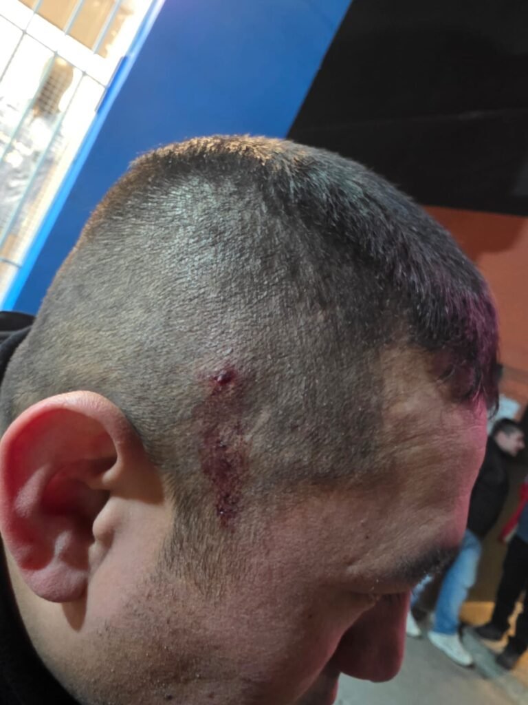 Disturbios en el Casino: tres detenidos tras brutal agresión a un policía