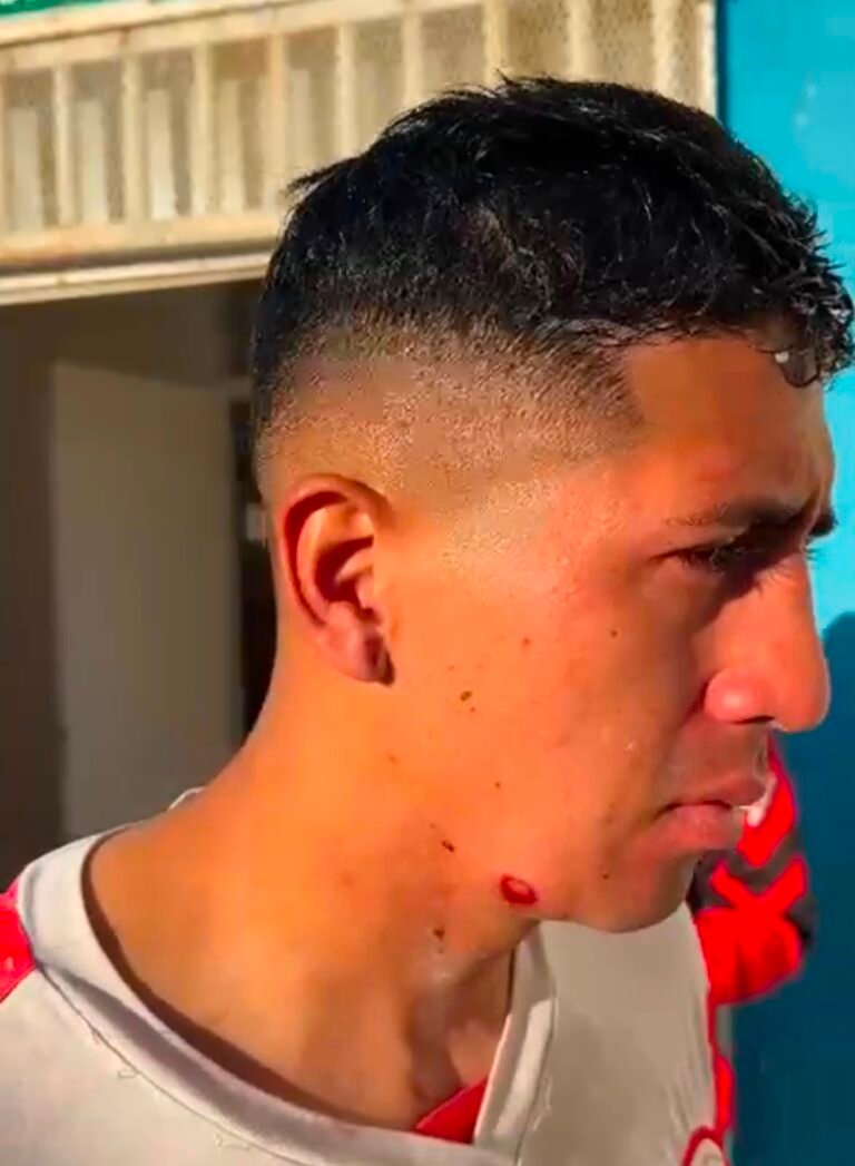 Huracán repudió la represión policial tras un partido: un jugador recibió un balazo de goma
