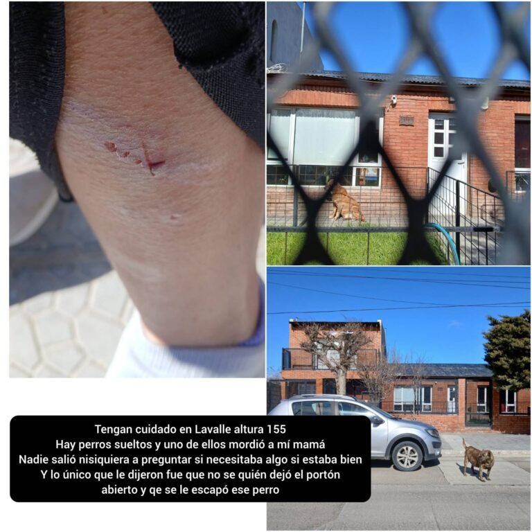 Una vecina fue atacada por un perro en Palazzo y cuestionan el silencio de la vecinal